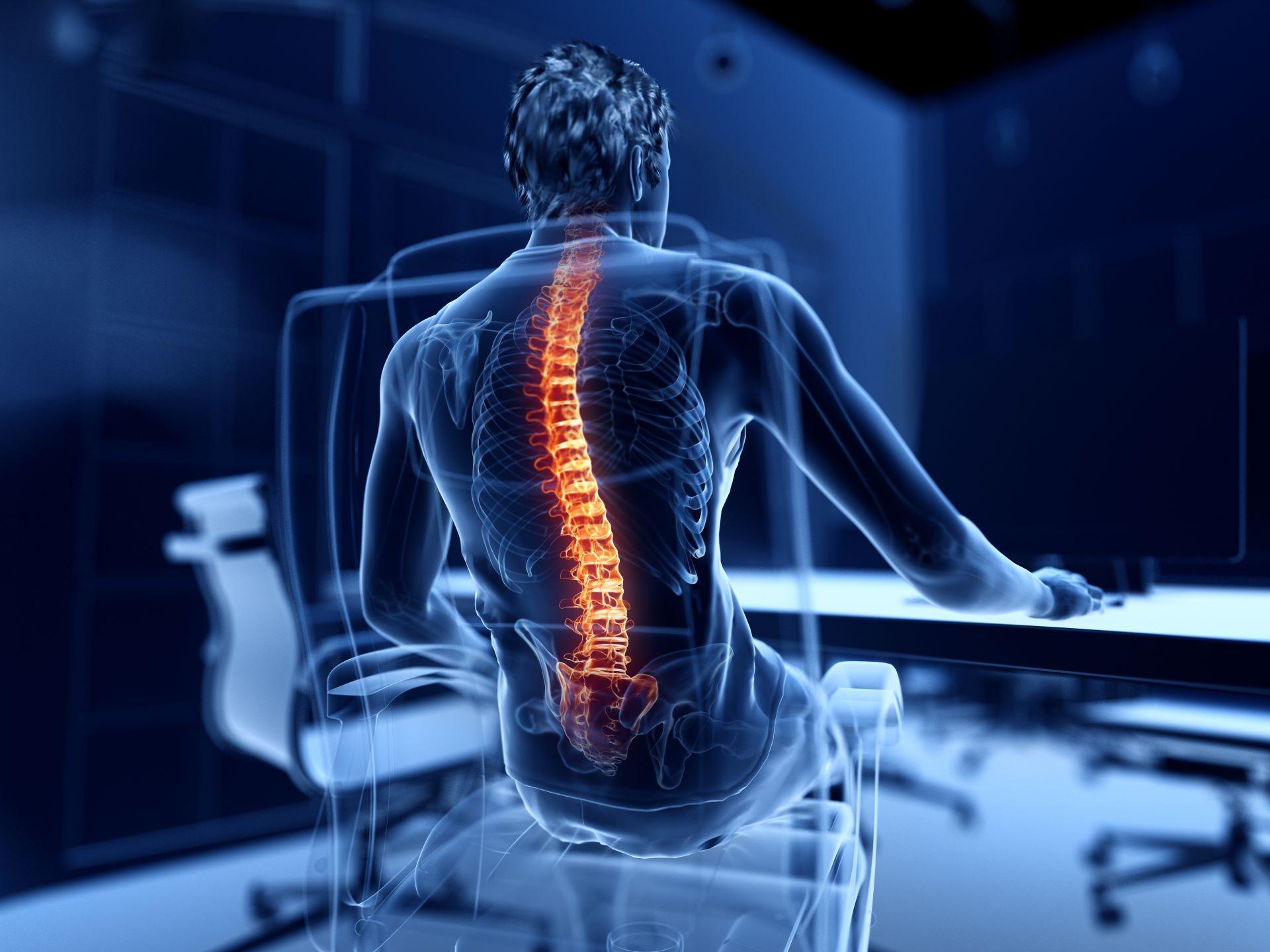 Visualisierung einer schmerzhaften Wirbelsäule – Wirbelsäulentherapie Erlangen